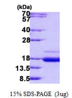 Human SSR2 Protein (Recombinant His)