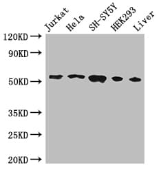 IHC-plus™ FKBP38 / FKBP8 Antibody