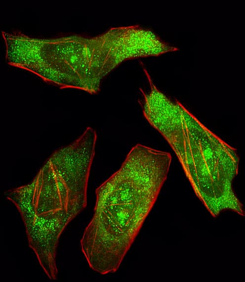 PTPN11 / SHP-2 / NS1 Antibody