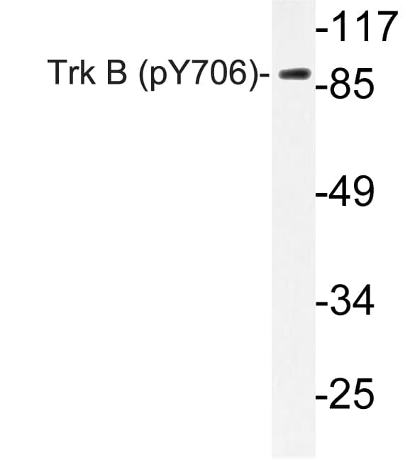 NTRK2 / TRKB Antibody (phospho-Tyr706)
