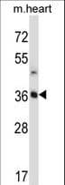 Polyclonal Rabbit anti-Human STC2 / Stanniocalcin 2 Antibody (aa273-302, IHC, WB)