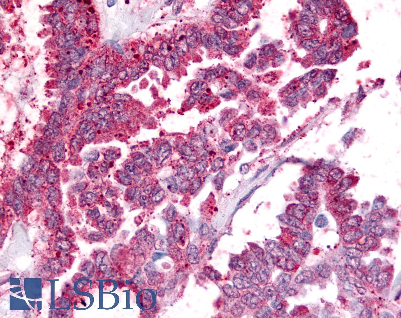 PathPlus™ Polyclonal Rabbit anti-Human PGES / PTGES Antibody (Cytoplasmic Domain, IHC)