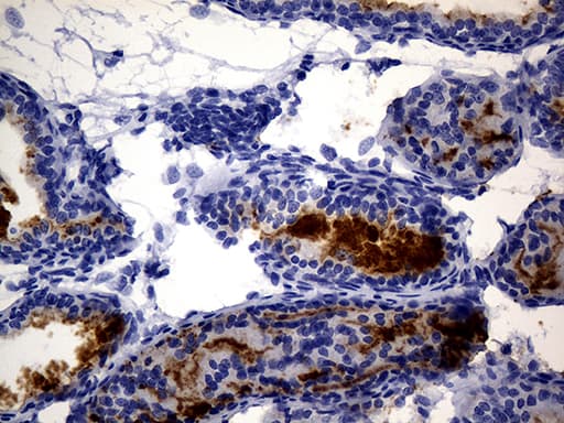 MME / CD10 Antibody (aa411-750, clone UMAB236)