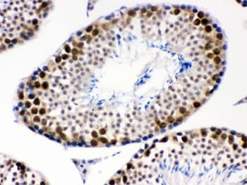 CDK1 / CDC2 Antibody