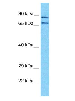 NBPF11 Antibody (aa321-370)