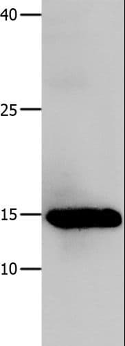 LGALS1 / Galectin 1 Antibody