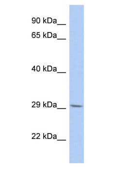 B3GNT6 Antibody (aa191-240)