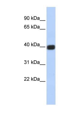 Polyclonal Rabbit anti-Human GJD2 / CX36 / Connexin 36 Antibody (C-Terminus, WB)