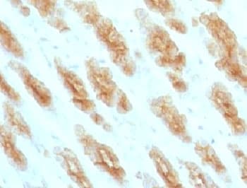 Basic Cytokeratin Antibody (clone BCCK1-1)