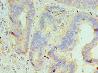 GUSB / Beta Glucuronidase Antibody (aa382-651)