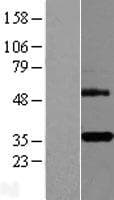 TNFRSF6B / DCR3 Protein (Over-Expression Lysate Myc-DDK (Flag))