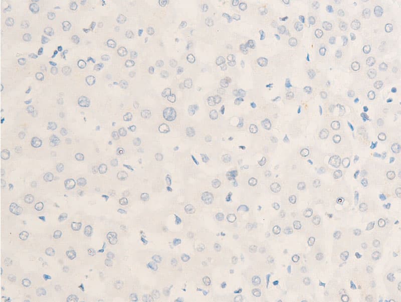 MYC / c-Myc Antibody (phospho-Thr58)