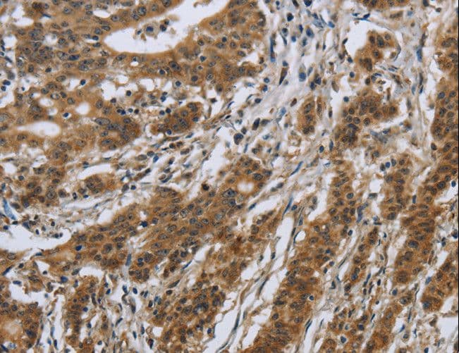 IL5RA / CD125 Antibody
