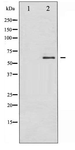 SMAD2 Antibody (phospho-Ser250)