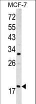 Polyclonal Rabbit anti-Human ARF3 Antibody (aa78-106, WB)