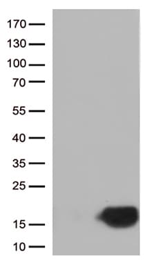 Monoclonal Mouse anti-Human CSTB / Cystatin B / Stefin B Antibody (clone OTI2A7, aa1-98, IHC, WB)