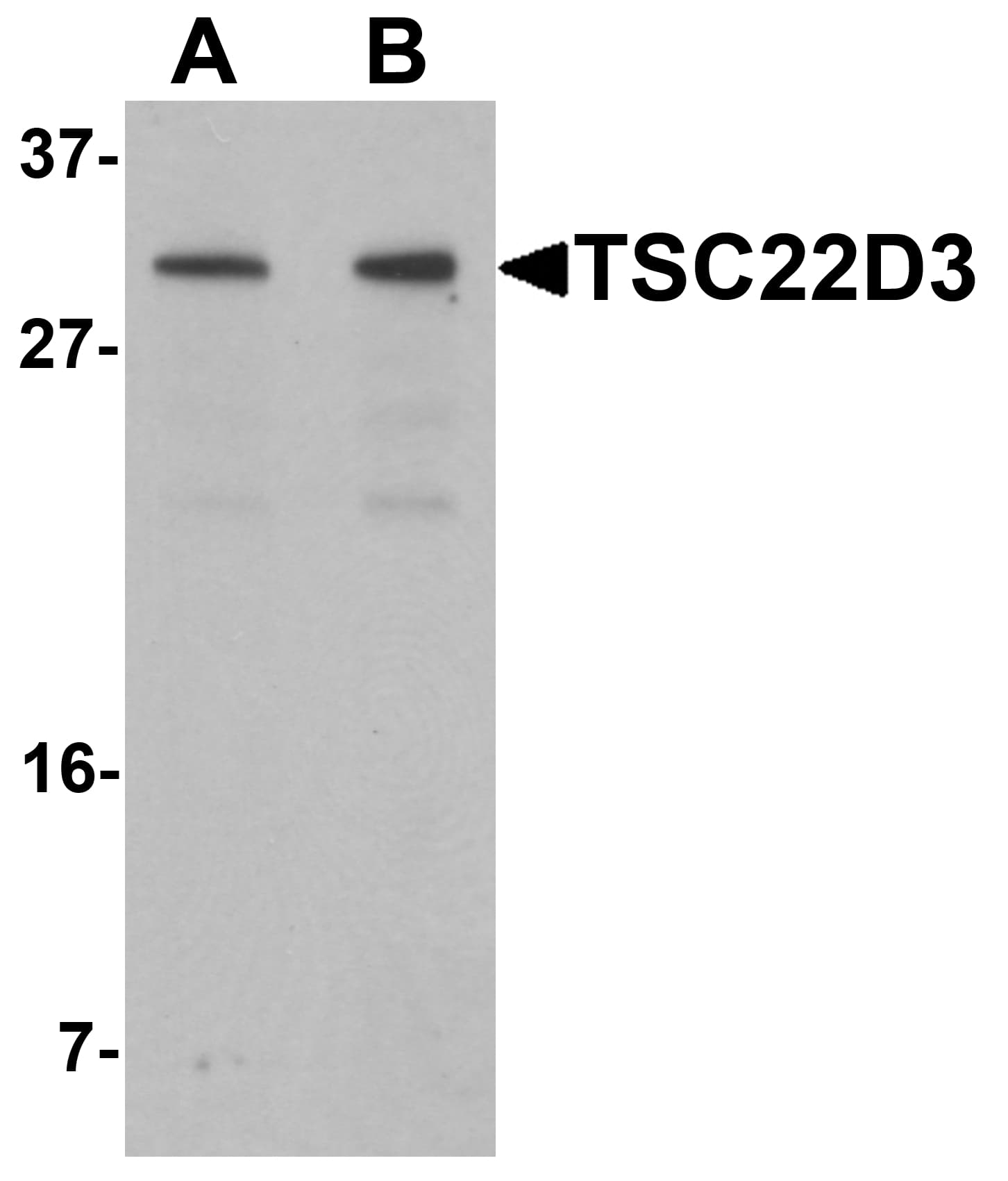 IHC-plus™ Polyclonal Rabbit anti-Human TSC22D3 / GILZ Antibody (IHC, IF, WB)