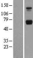 PPM1G Protein (Over-Expression Lysate Myc-DDK (Flag))