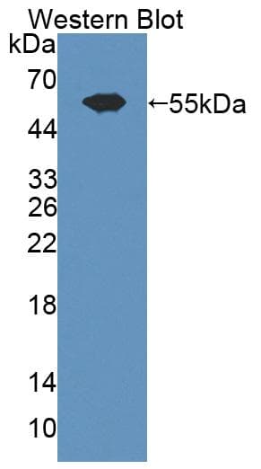 ADAMTS13 Antibody (Biotin)