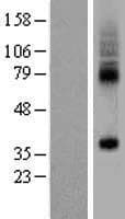 SLC35F5 Protein (Over-Expression Lysate Myc-DDK (Flag))