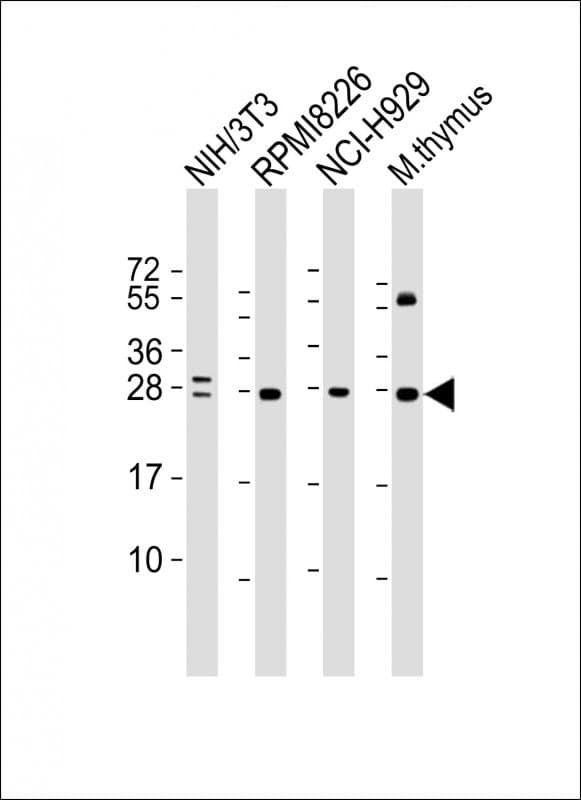 Monoclonal Mouse anti-Human FGFR1OP2 Antibody (clone 1675CT713.89.84, WB)