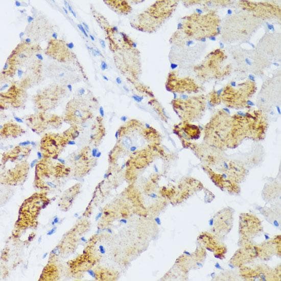 Polyclonal Rabbit anti-Human WSB2 Antibody (IHC)