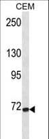 FZD3 / Frizzled 3 Antibody (aa496-525)