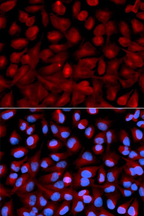 HDAC6 Antibody