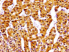 NPC / NPC1 Antibody