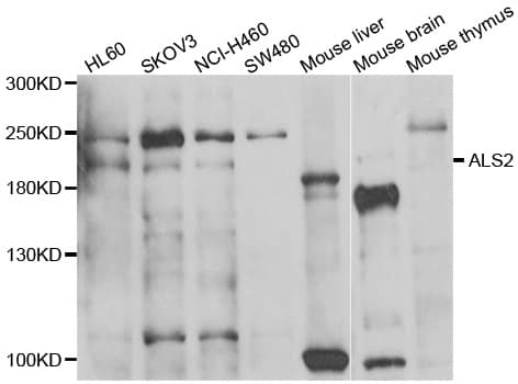 ALS2 / Alsin Antibody