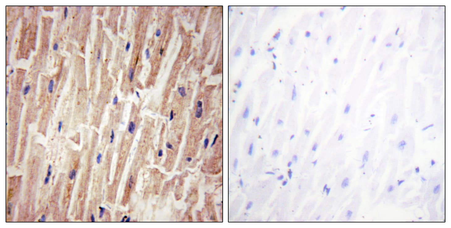 YAP / YAP1 Antibody (phospho-Ser127)