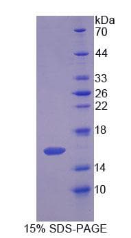 Rat SCP2 / SCPX Protein (Recombinant His-T7, N-terminus)