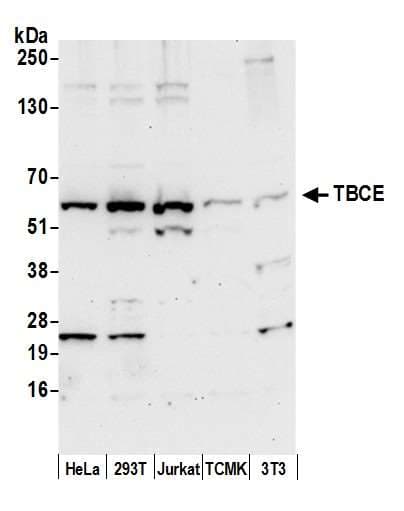 Polyclonal Rabbit anti-Human TCBE / KCS / HRD Antibody (aa25-75, WB)