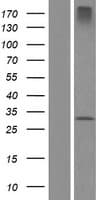 ZDHHC24 Protein (Over-Expression Lysate Myc-DDK (Flag))
