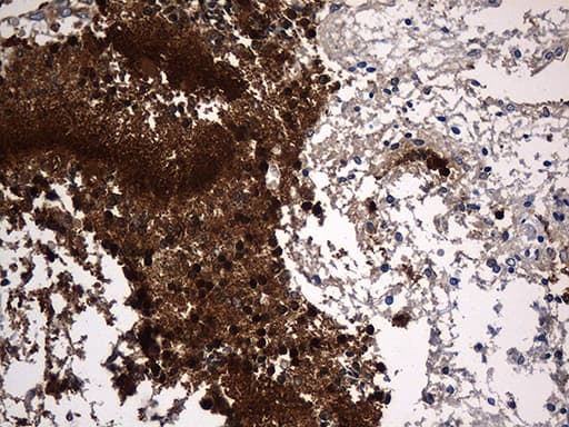 PPP3CA / CCN1 / Calcineurin A Antibody (aa2-105, clone OTI5C6)