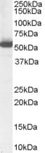 IHC-plus™ ALDH1A1 / ALDH1 Antibody (aa476-488)