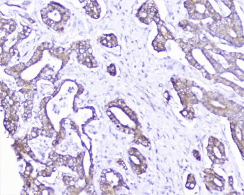 Polyclonal Rabbit anti-Human CTTN / Cortactin Antibody (IHC, IF, WB)
