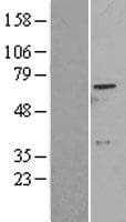 ADCK2 Protein (Over-Expression Lysate Myc-DDK (Flag))