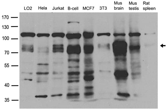 PRKCD / PKC-Delta Antibody