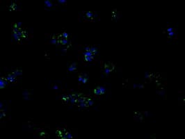 PIM2 / Pim-2 Antibody (clone OTI8G10)