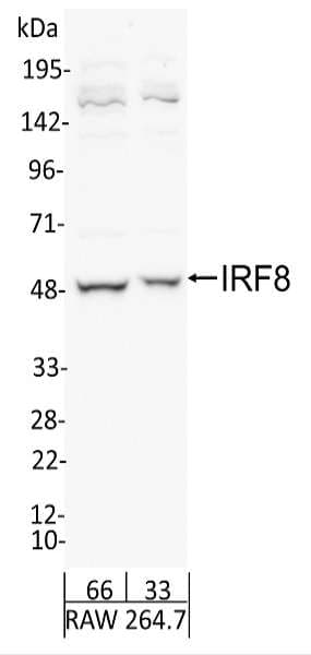 ICSBP / IRF8 Antibody (aa374-424)