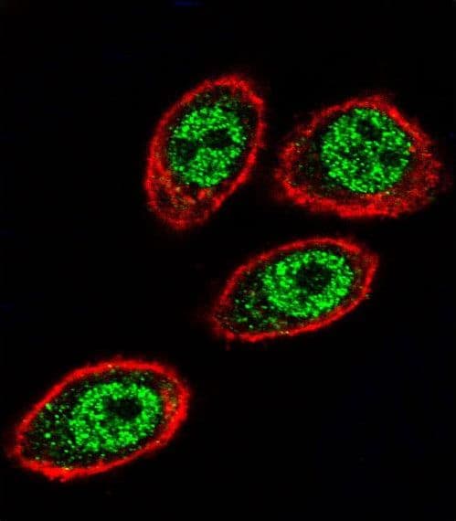 PHB / Prohibitin Antibody (aa89-117)