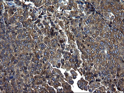 Monoclonal Mouse anti-Human PDCD6IP / ALIX Antibody (clone OTI1A4, IHC, WB)