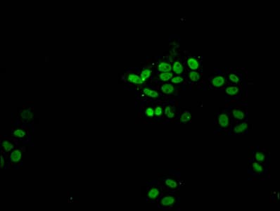 Polyclonal Rabbit anti-Human HIST1H1A Antibody (IF)