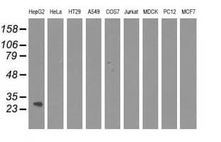 QPRT Antibody (clone OTI4E6)