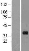 MARCH8 Protein (Over-Expression Lysate Myc-DDK (Flag))