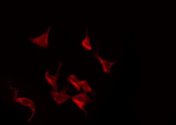 Polyclonal Rabbit anti-Human EIF2S1 Antibody (phospho-Ser51, IHC, IF, WB)