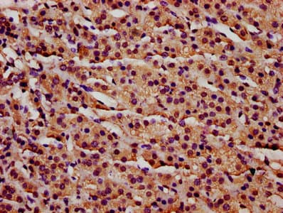 IFT140 Antibody
