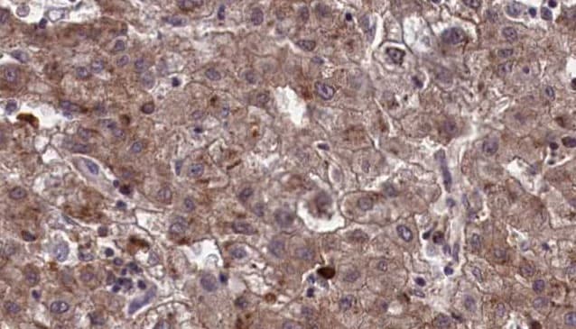 Polyclonal Rabbit anti-Human OR10Q1 Antibody (IHC, WB)