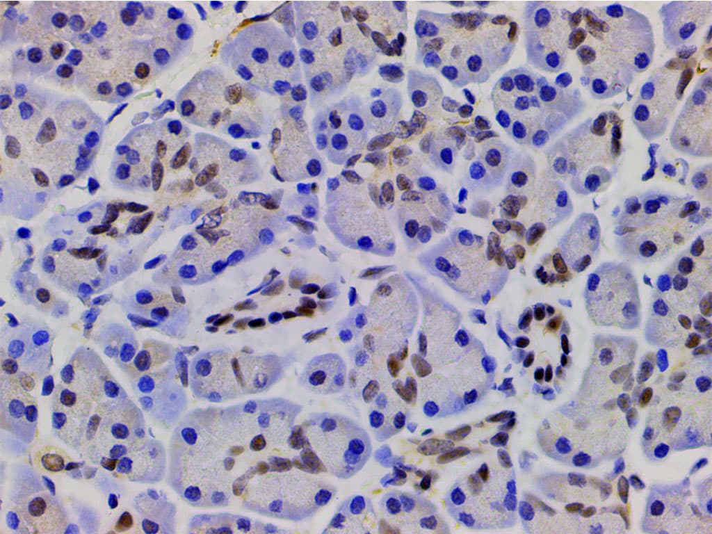 CFL1 / Cofilin Antibody (phospho-Ser3)